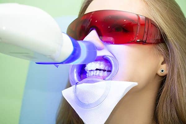 Laser teeth whitening treatments Buckinghamshire