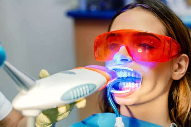 Simplifying Teeth Whitening: A Comprehensive Guide Buckinghamshire