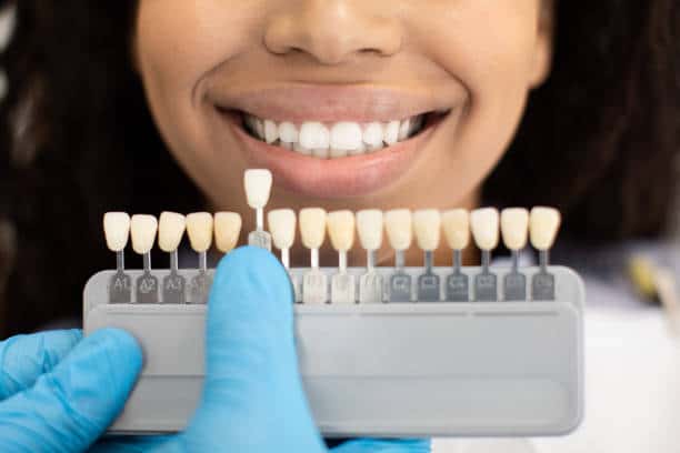 Laser Teeth Whitening: Exploring the Longevity of Your Brighter Smile Buckinghamshire