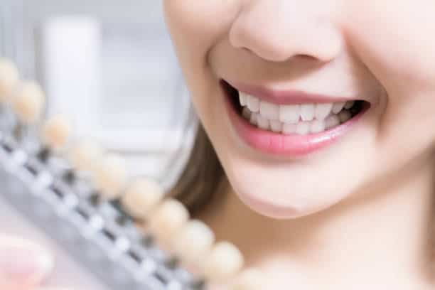 Teeth Whitening Kings Norton Buckinghamshire