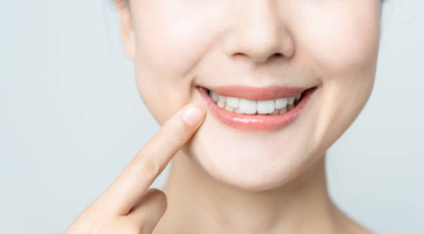 Comparing the Pain Factor: Laser Teeth Whitening vs. Zoom Teeth Whitening Buckinghamshire