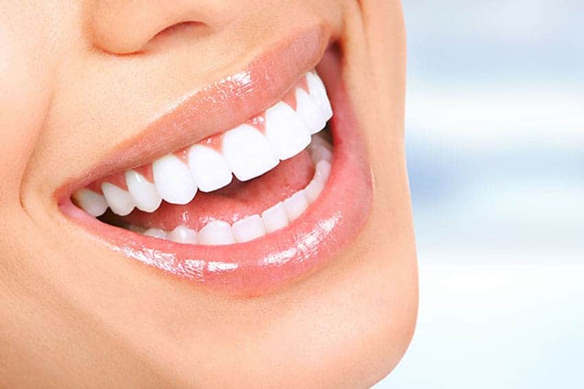 Teeth Whitening Abingdon Buckinghamshire